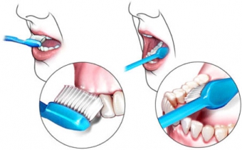 как правильно чистить зубы
